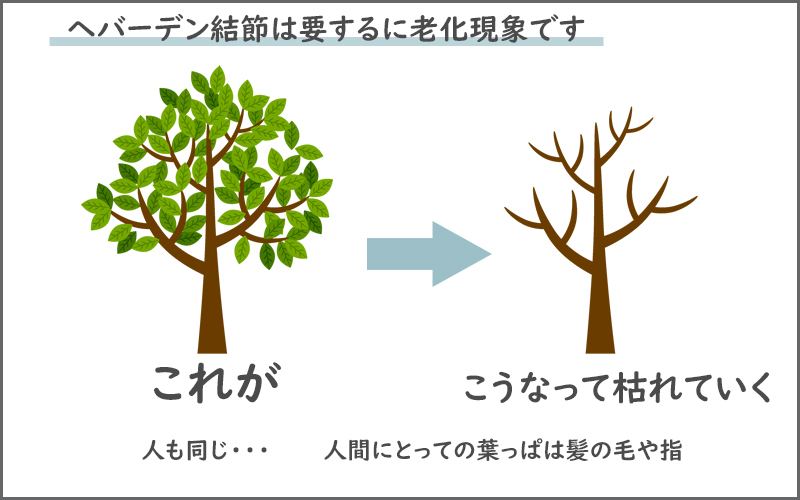 ヘバーデン結節は要するに老化現象です。